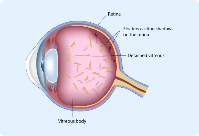 Retina Diagram