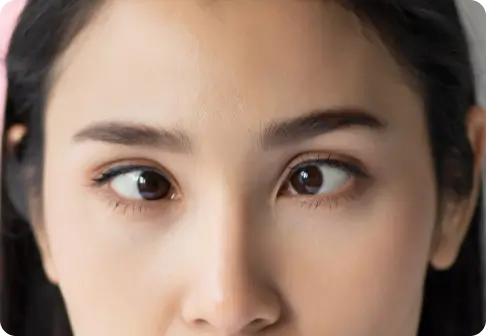 Squint